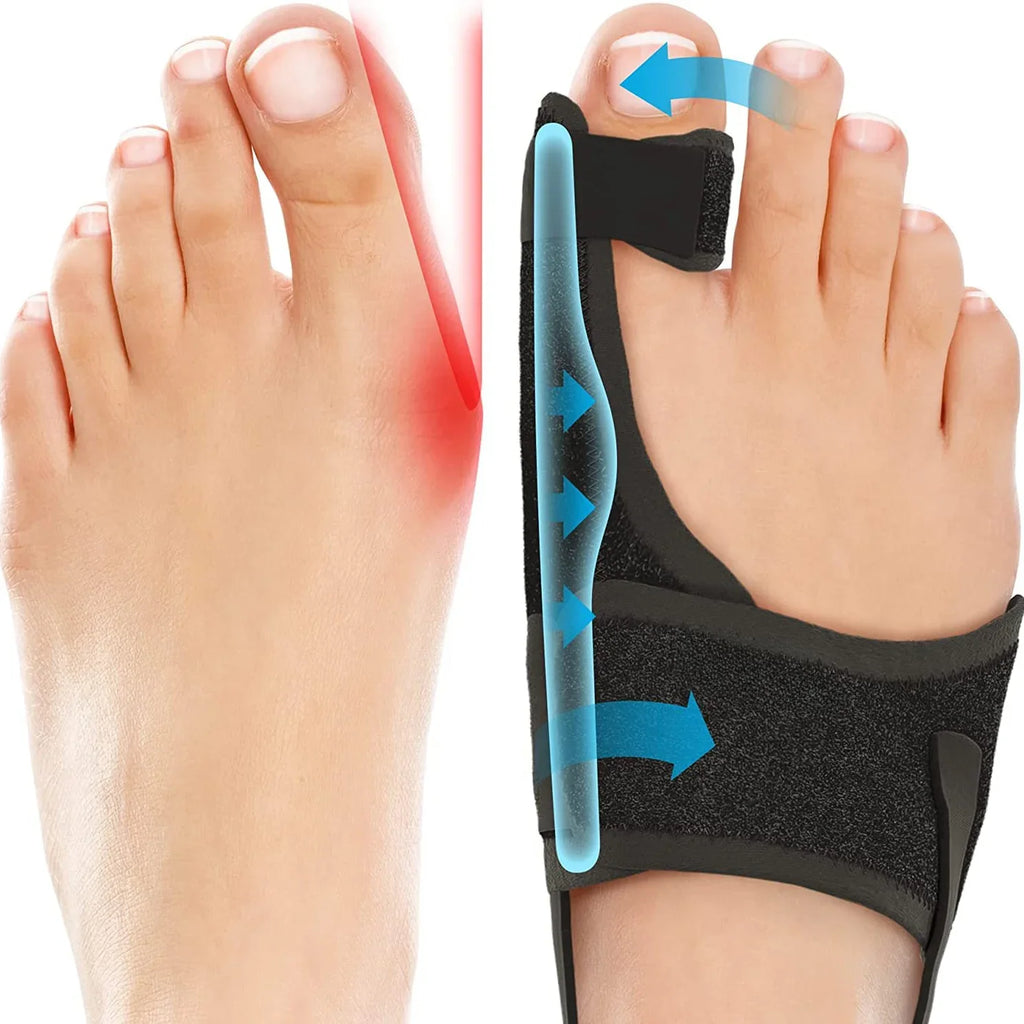 Attelle hallux valgus avec barres réglables