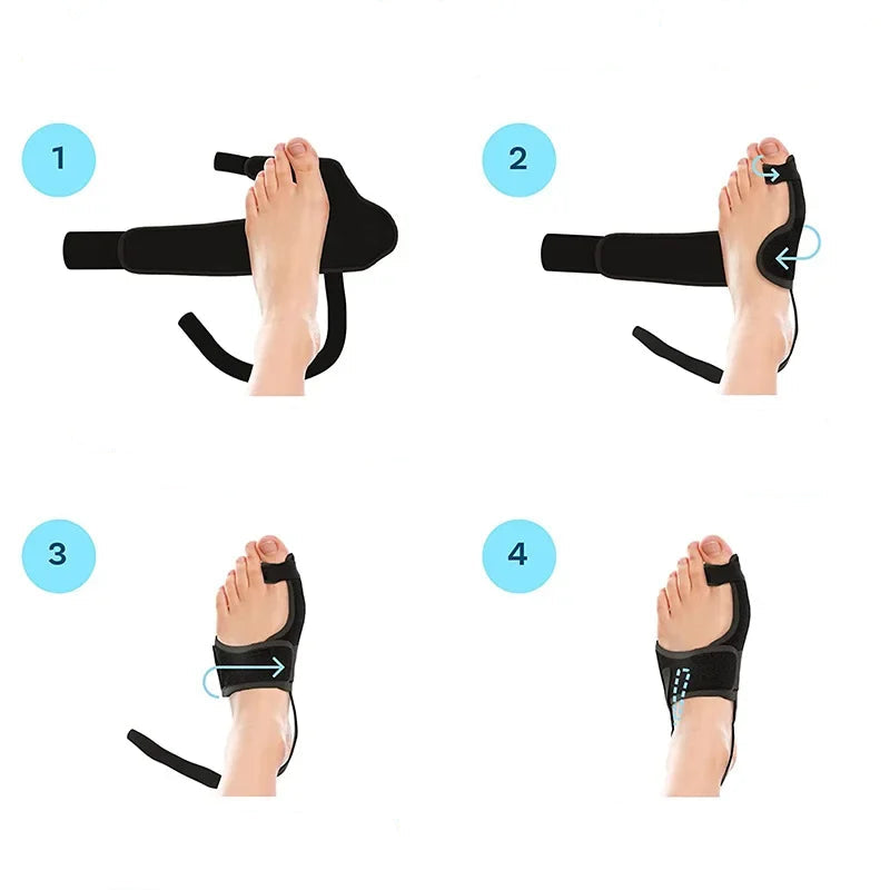 Attelle hallux valgus avec barres réglables