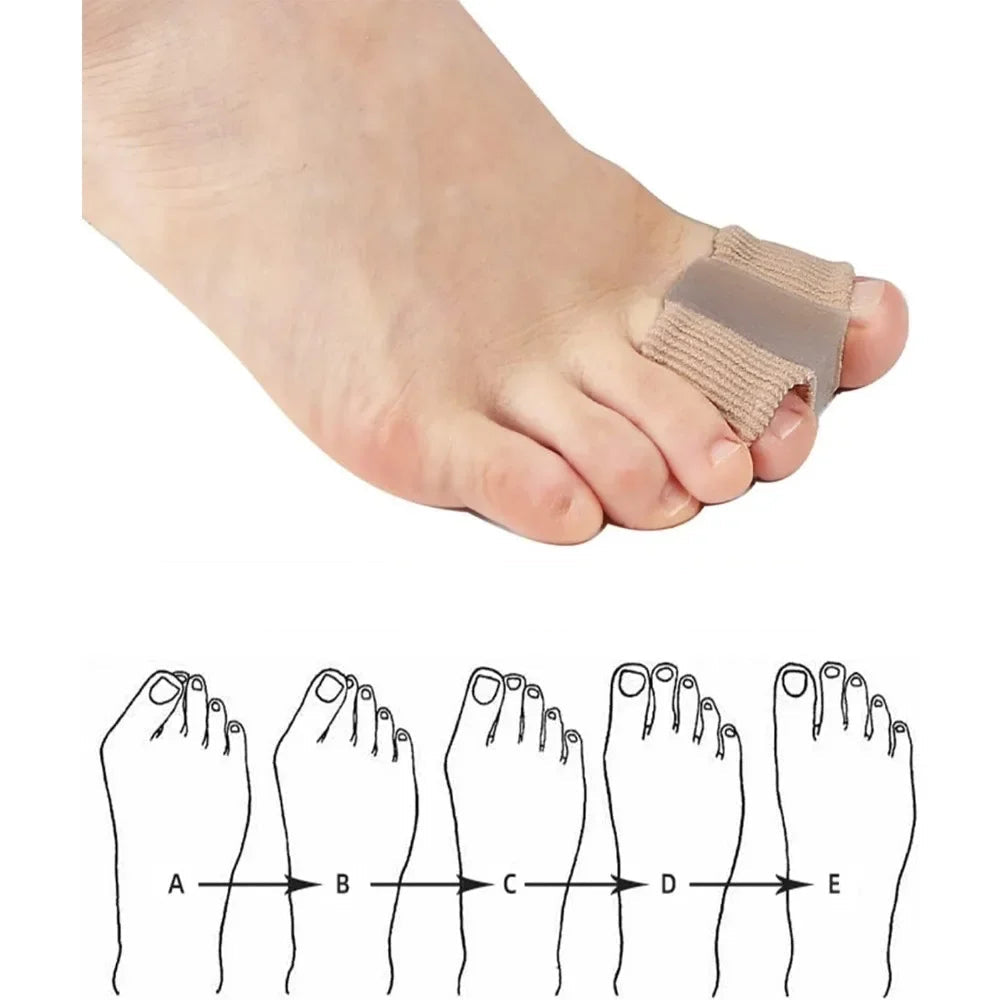 Ecarteur d'orteils Hallux Valgus