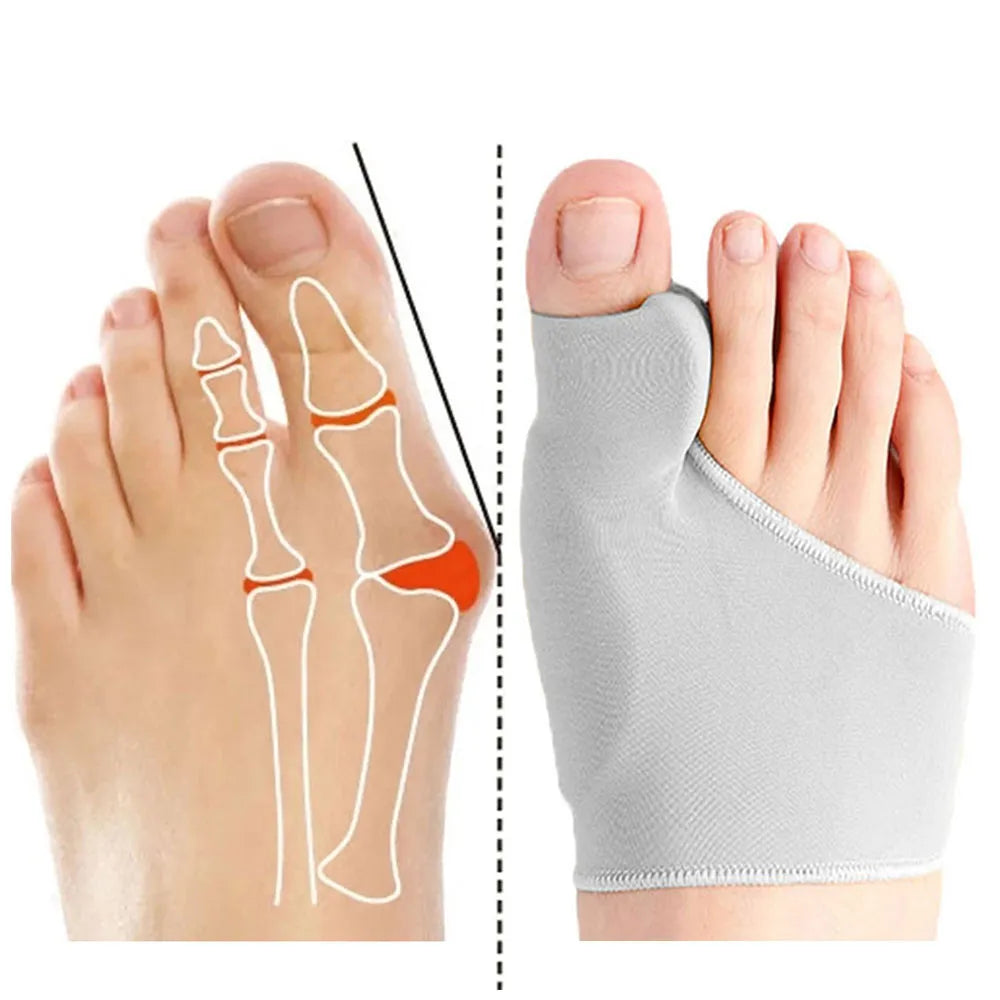 Orthèse hallux valgus gel
