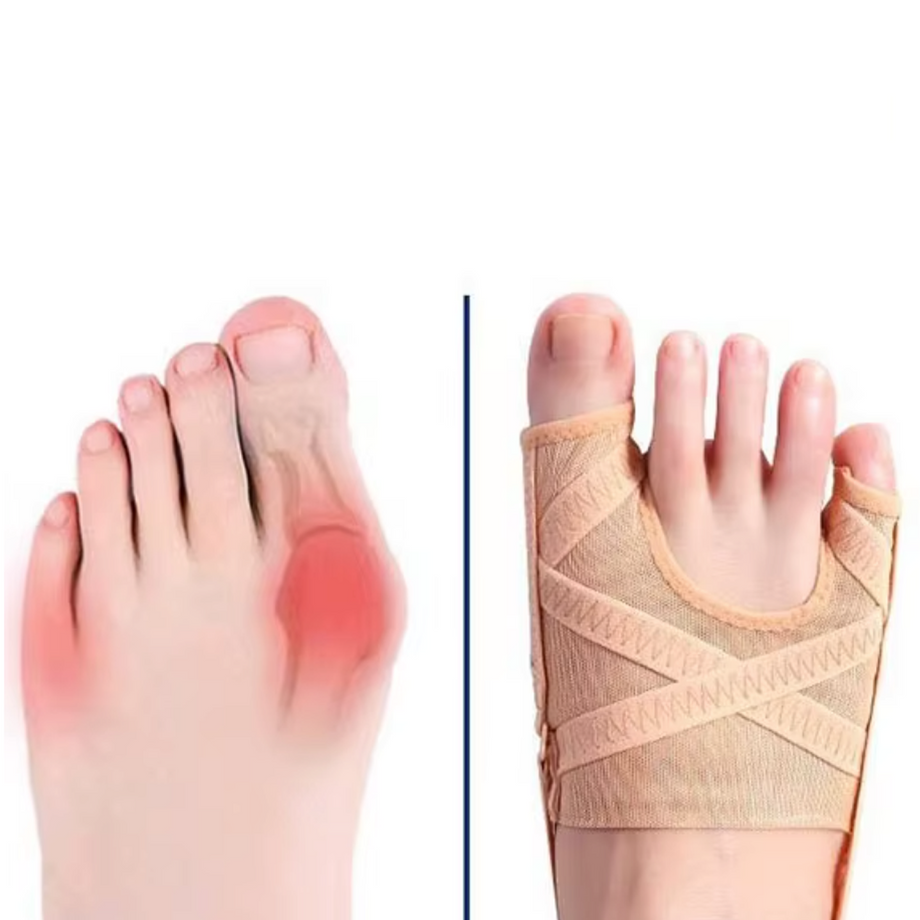 Orthèse hallux valgus souple – Attelle Solution - Main Image